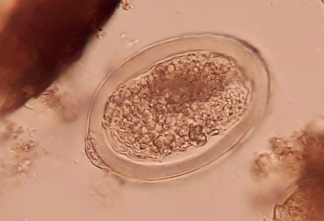 Ägg från fiskbinnikemask (Diphyllobothrium latum) funnet i latrinmaterial från 1000-talet. Ägget är 75 x 45 tusendels millimeter stort. Man kan infekteras av fiskbinnikemask om man äter otillräckligt tillagad insjöfisk, tex torkad fisk